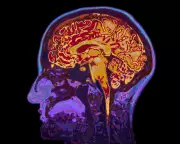 The Nocebo Effect: How Negative Thoughts Can Make You Ill