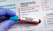 UK Rejects Prostate Cancer Screening for Most Men, Sparking Outrage