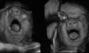 Unborn Babies Catch Yawns from Mothers, Study Reveals