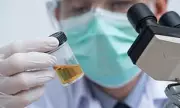 Urine test for lung cancer could be rolled out on NHS within five years