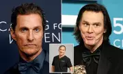 Why Male Celebrities Look Unrecognizable: Plastic Surgeon Reveals