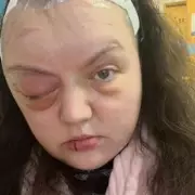 Woman Sues Pfizer Over Brain Tumour from 21 Years of Contraceptive Jab