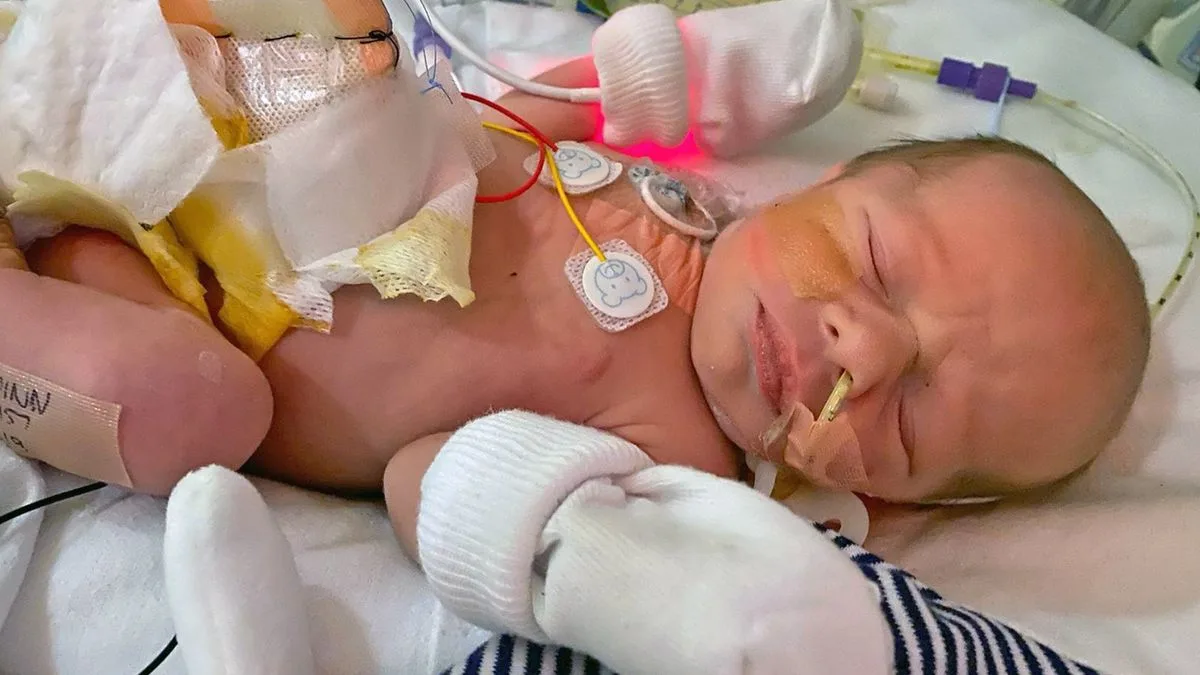 Miracle Baby Survives After Intestines Grew Outside Body
