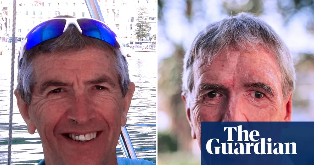 Cyclist, 75, Receives 3D-Printed Face After Drunk Driver Crash