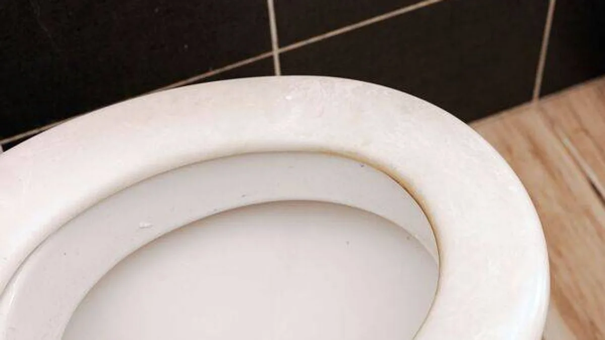 40p Hack Removes Yellow Toilet Stains Instantly