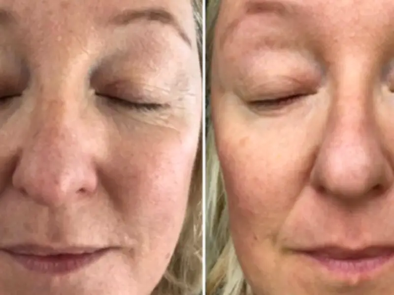 74-Year-Old Credits 84p-a-Day Drink for Wrinkle-Free Skin