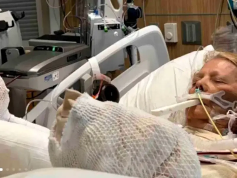 82-Year-Old Woman Fights for Life After Falling Asleep in Arizona Sun