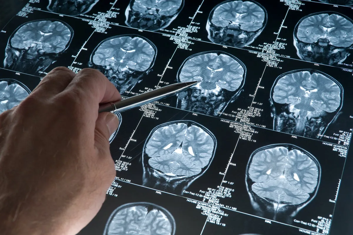Adolescence Lasts Until Your Early 30s, Major Brain Study Finds