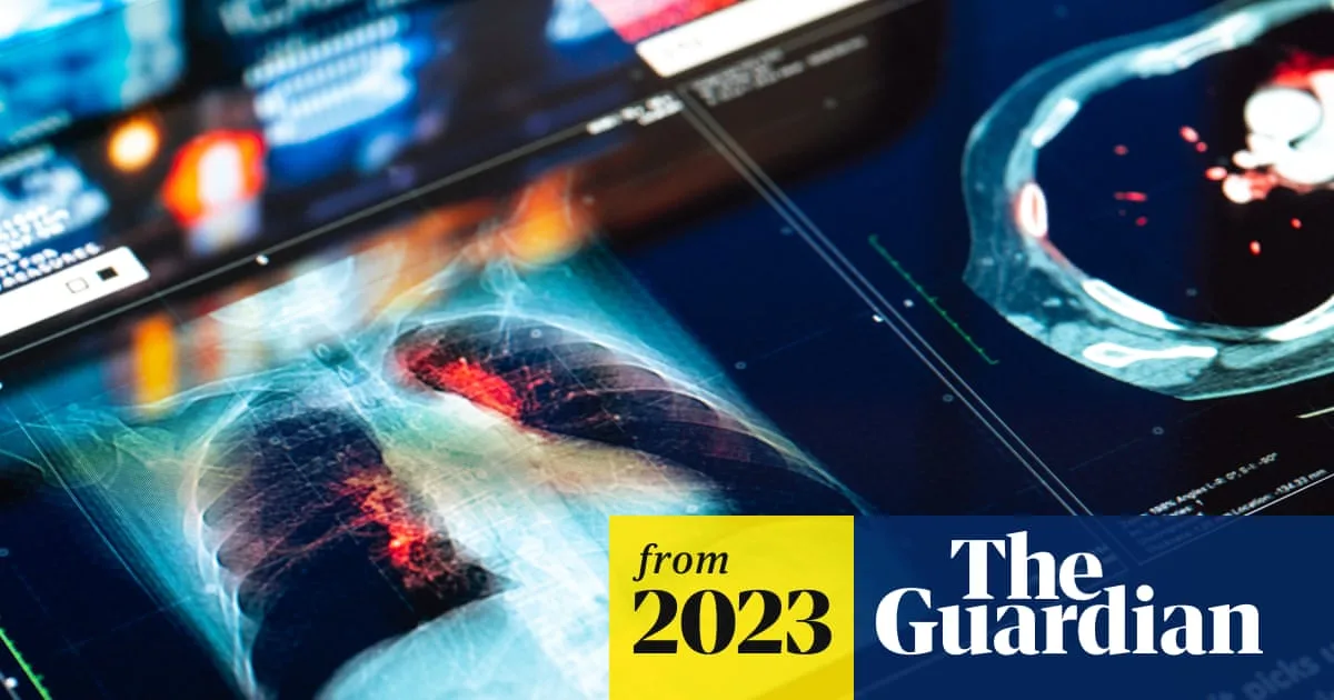 Air Pollution Speeds Up Chronic Disease Onset In UK