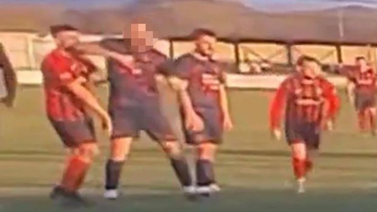 Amateur Footballer Bailed After Elbow Attack During Match