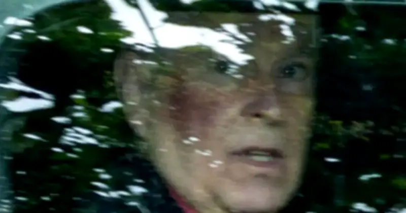 Andrew Mountbatten-Windsor's Black Eye: New Theory Emerges