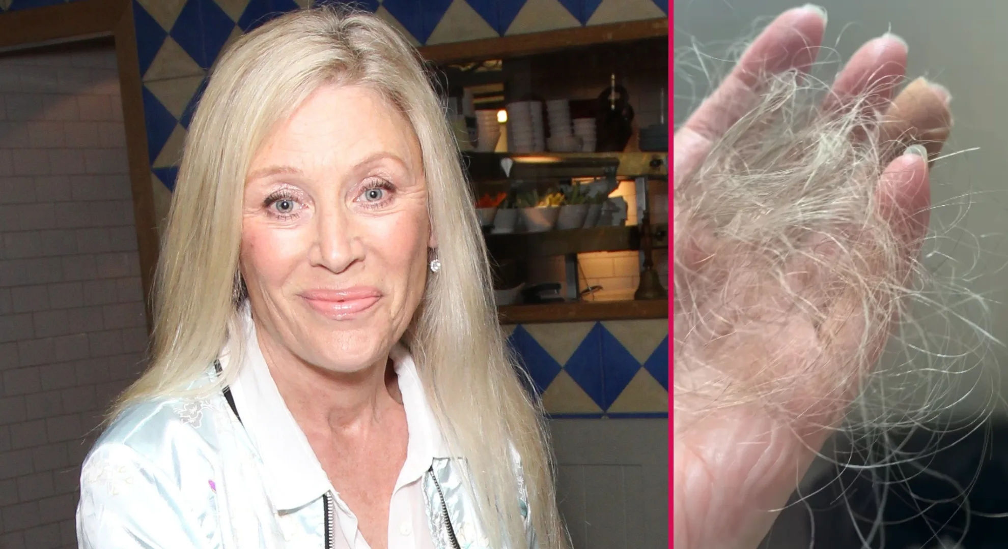Angie Best Jokes She Has Only 15 Hairs Left After Chemo