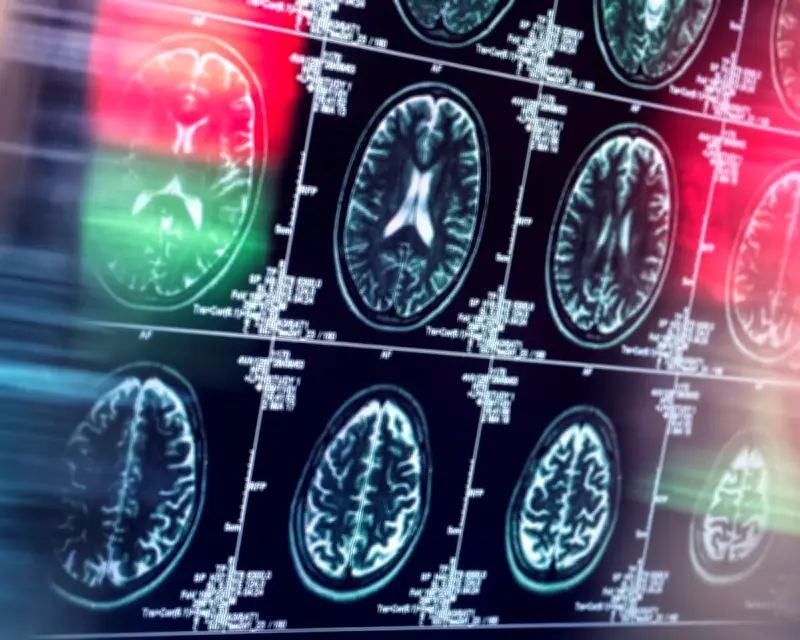 Antidepressants and Antipsychotics Could Replace Opioids for Pain, Study Finds