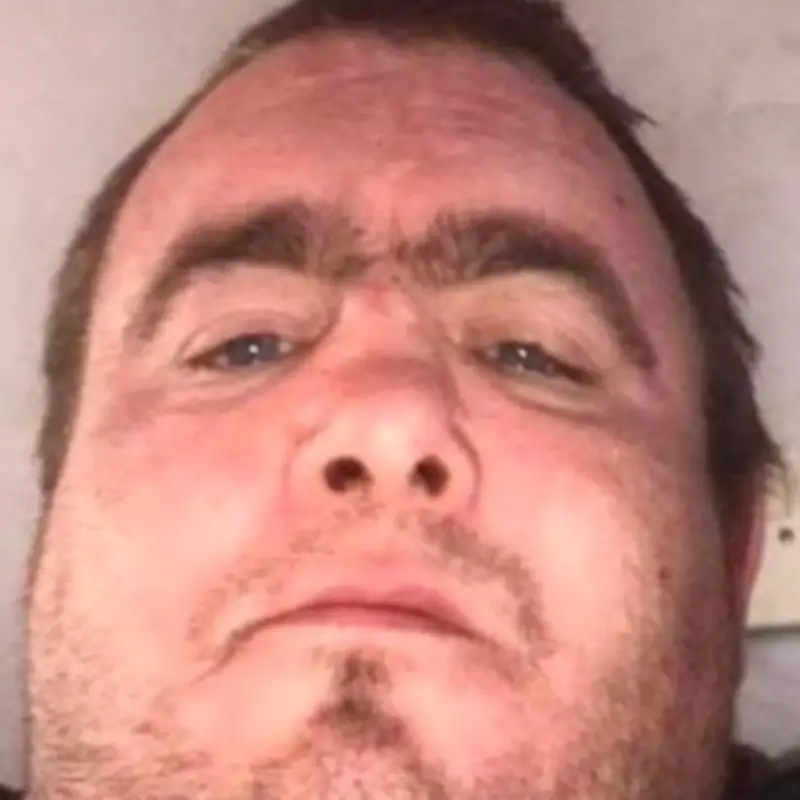 Belfast knife attack victim loses eye in horrific 'attempted beheading'