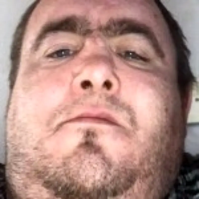 Belfast Knife Attack Victim Was Drugged and Set on Fire in Previous Assault