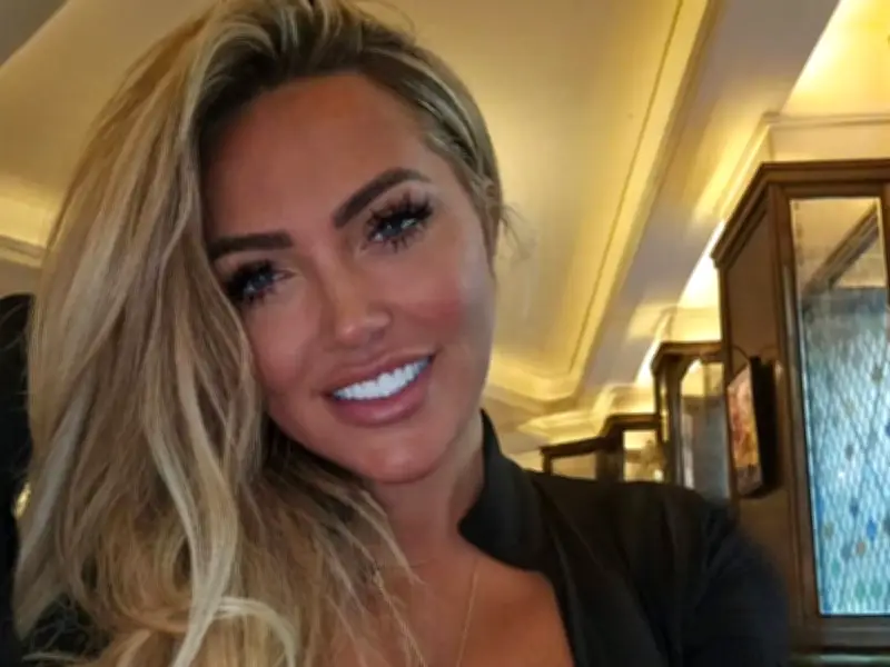 Big Brother's Aisleyne Horgan Wallace 'scarred for life' after XL Bully attack