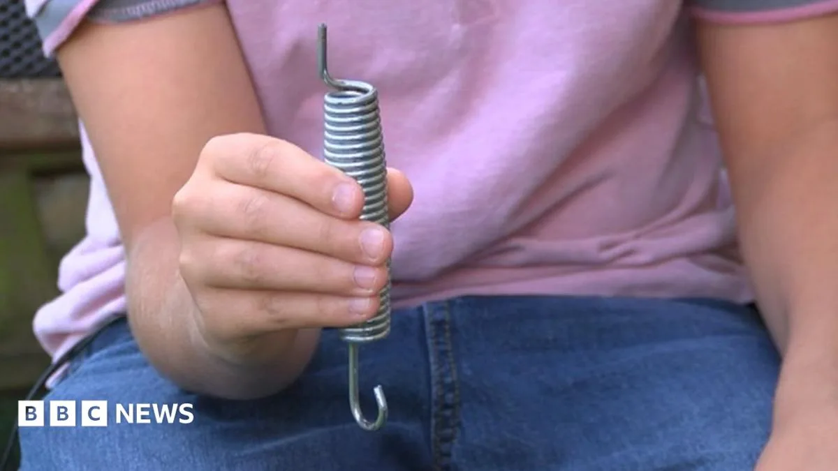 Boy, 12, 'lucky to be alive' after trampoline spring impales his back