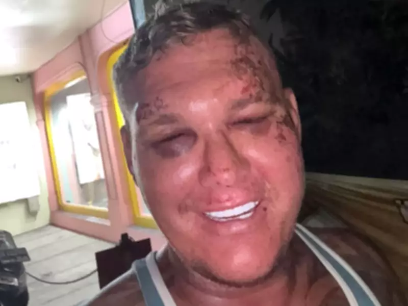 British Tourist Drugged, Attacked, and Robbed of £1,800 in Bali