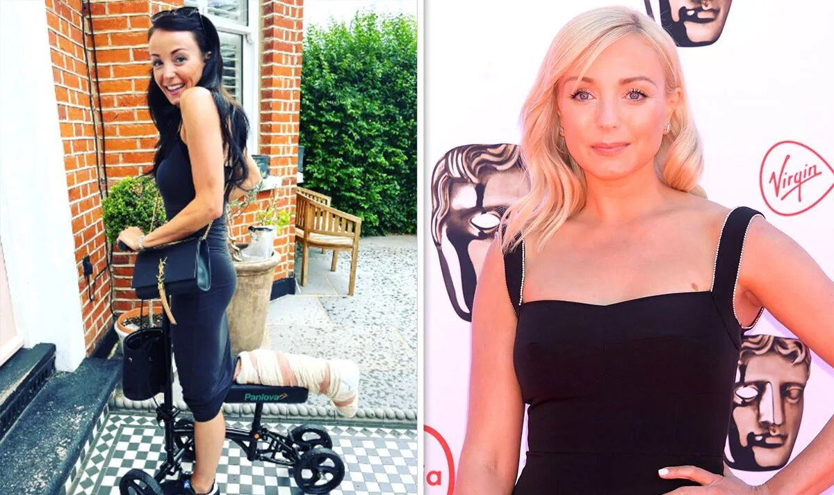 Call the Midwife Star Helen George Reveals Leg Injury