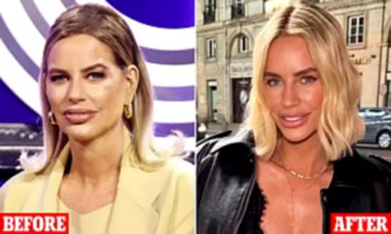 Caroline Stanbury Stuns Fans with Before and After Facelift Photos