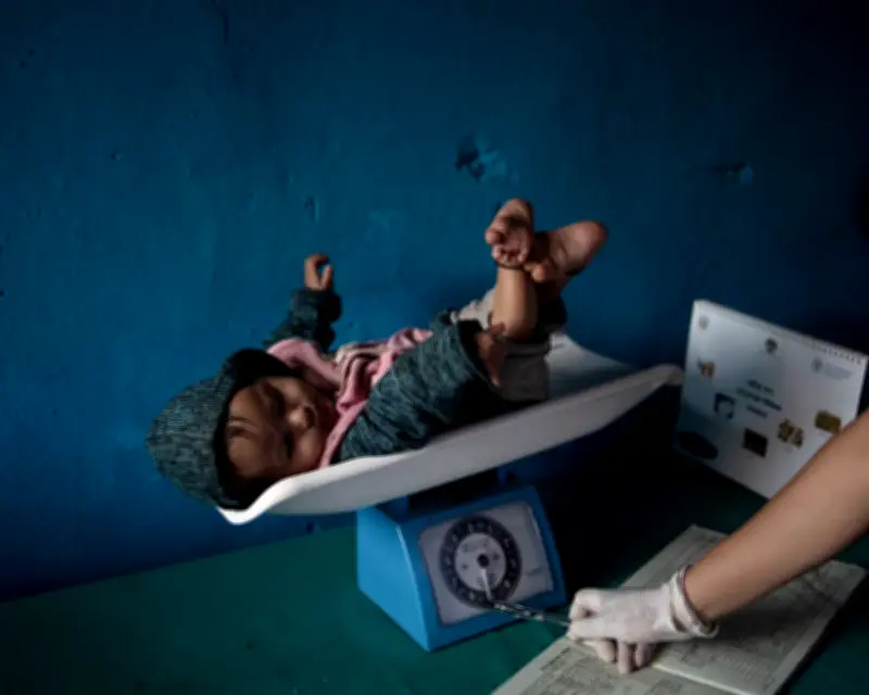 Child Malnutrition in Nepal Reaches Alarming Levels After USAID Cuts