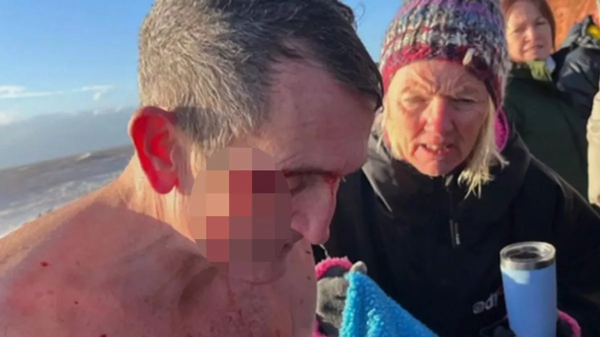 Christmas Day Swim Survivor Saved By Brave Bystanders In Devon