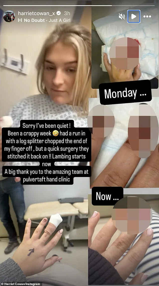 Clarkson's Farm Star Harriet Cowan Rushed to Hospital After Severing Finger in Log Splitter Accident