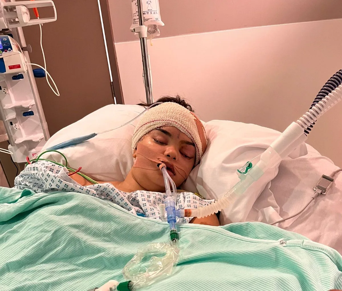 London Teen's Cold Led to Life-Threatening Brain Infection