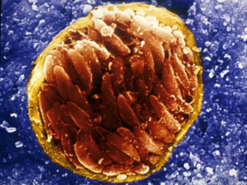 Common Cat Parasite Could Cause Blindness in Billions, Scientists Warn