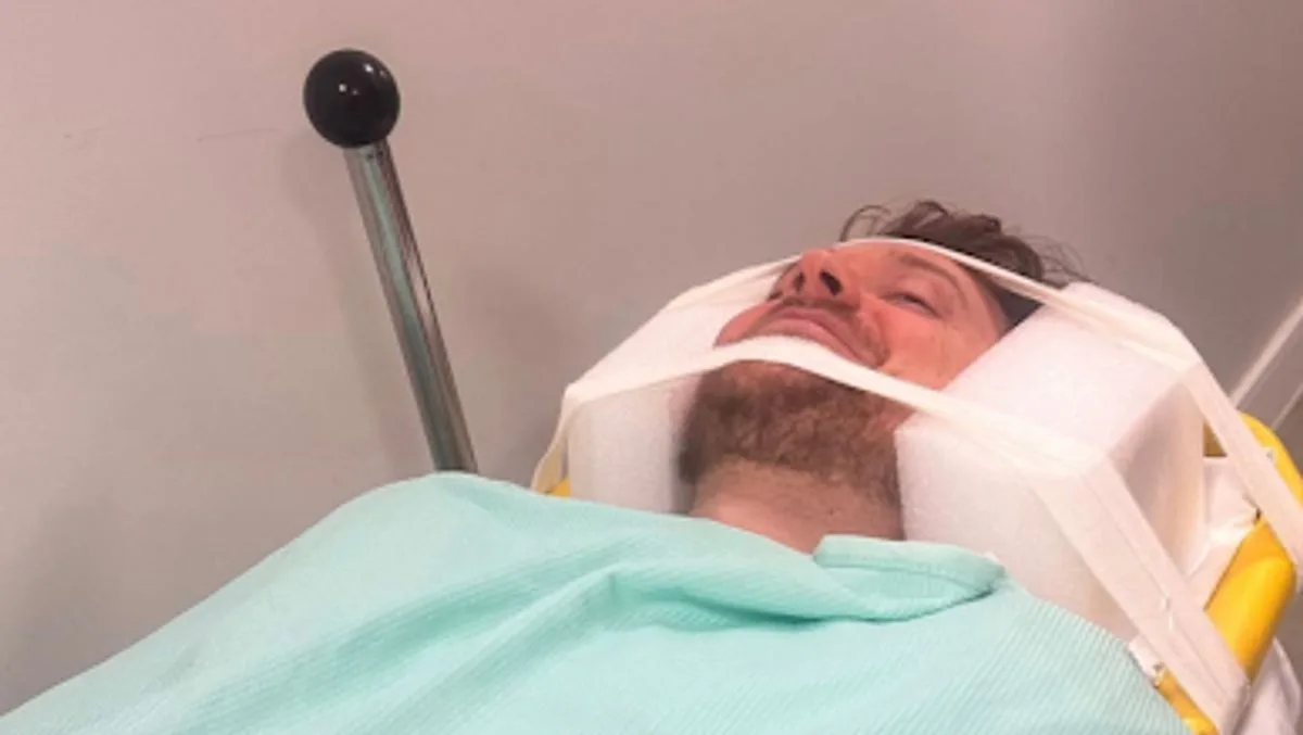 Conor Maynard Hospitalised After Falling Down Stairs