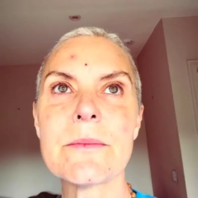Coronation Street's Tracy Shaw in Tears After A&E Visit During Chemo
