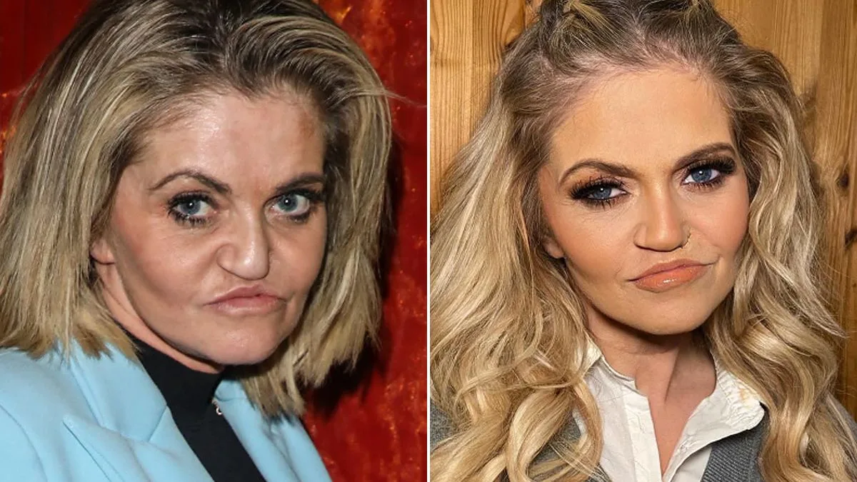 Danniella Westbrook's Cosmetic Surgery 'Nightmare' After Drug Addiction
