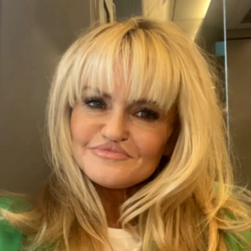 Danniella Westbrook reveals 'no bone' on one side of face amid reconstruction