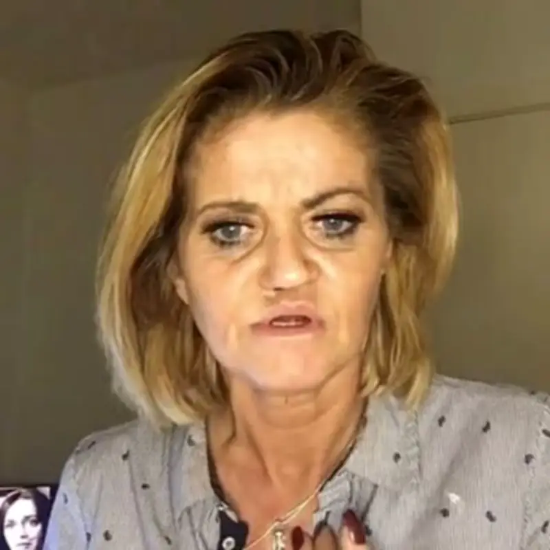 Danniella Westbrook to undergo six more surgeries after 'no bone' on face side