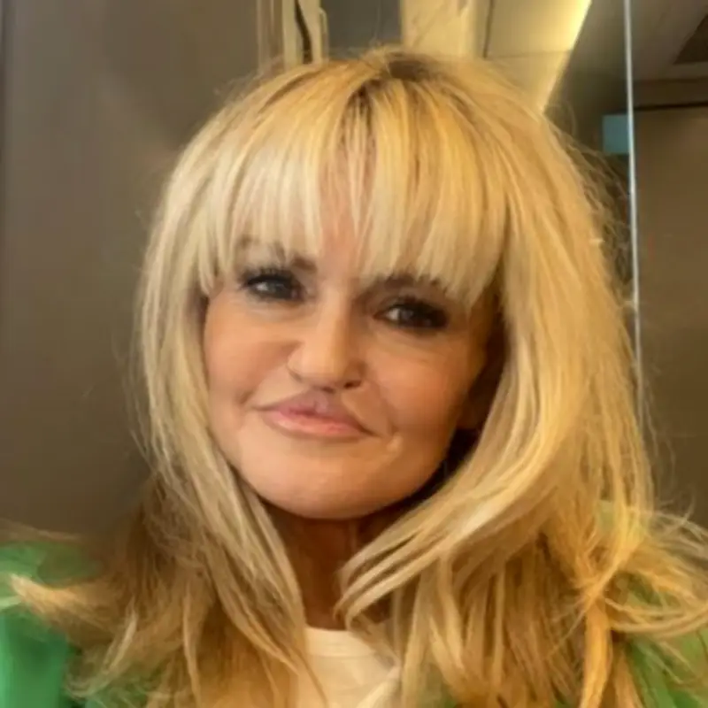 Danniella Westbrook's Journey: From Fresh-Faced Star to Facial Reconstruction