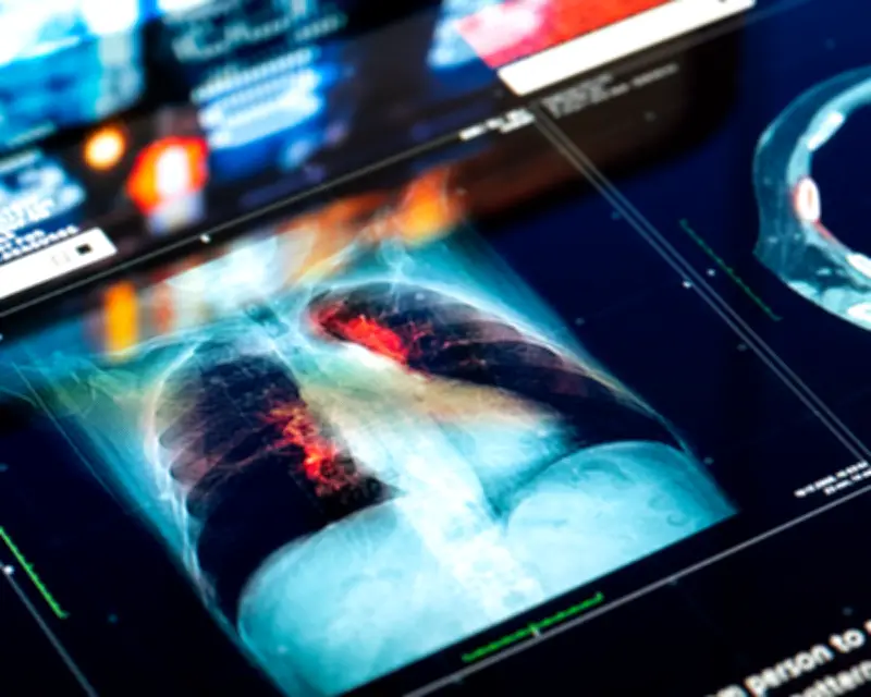 Doctors could face lawsuits over AI tool mistakes, warns report