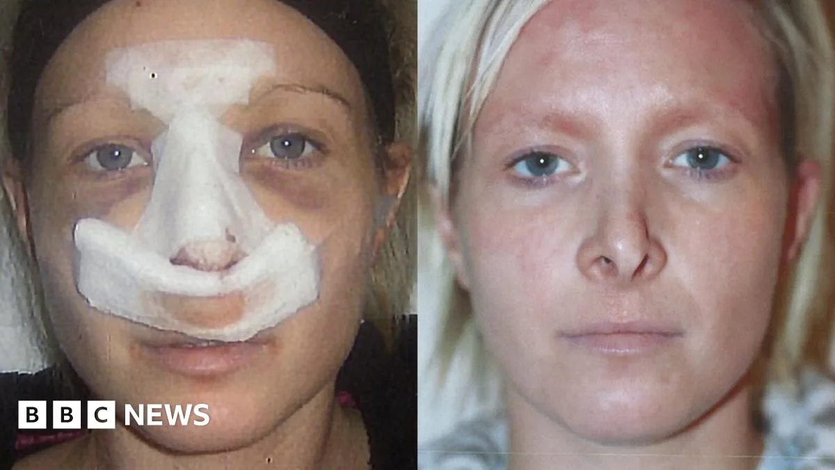 Patients Left Exposed as Cosmetic Surgeons Fly In and Out of UK
