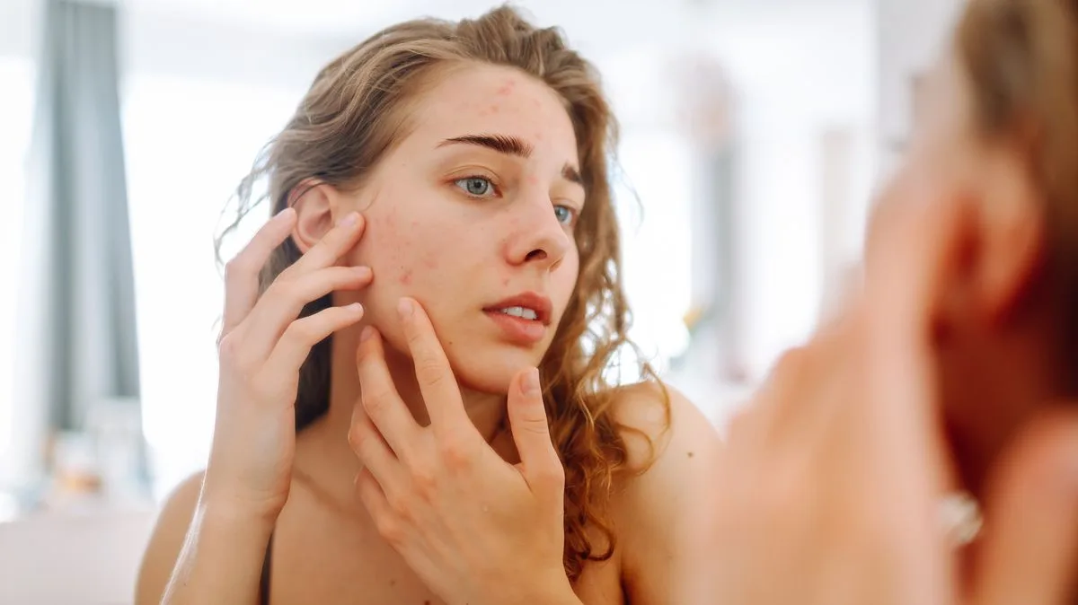 Doctors Warn Never to Pop Spots in the 'Triangle of Death' on Your Face