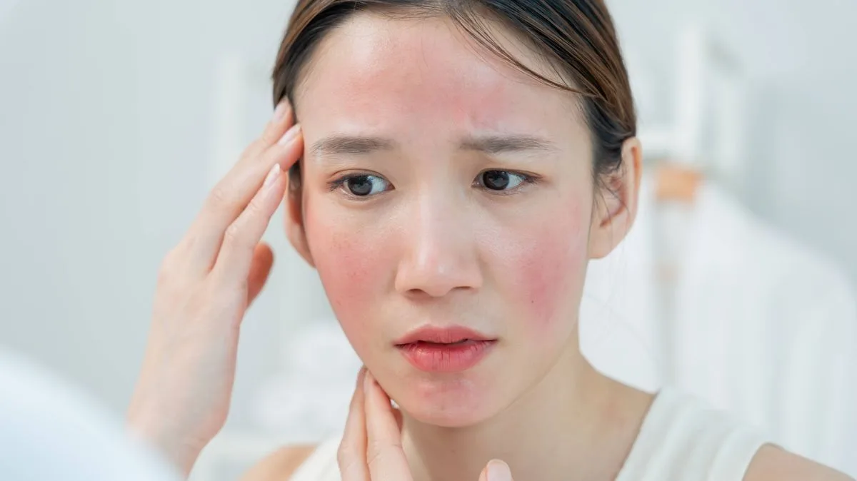NHS Issues Sunburn Warning and Treatment Advice After UK Heatwave