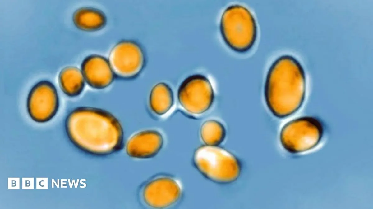 Drug-Resistant Super Fungus Candida Auris Spreads in UK