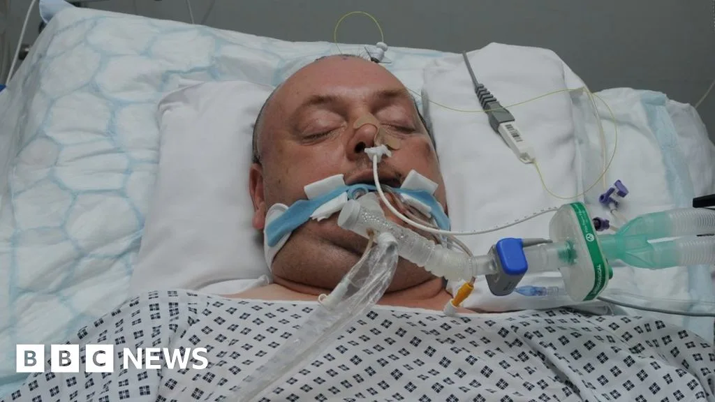 Bride's Plea After Father Left in Coma Following Stag Do Assault