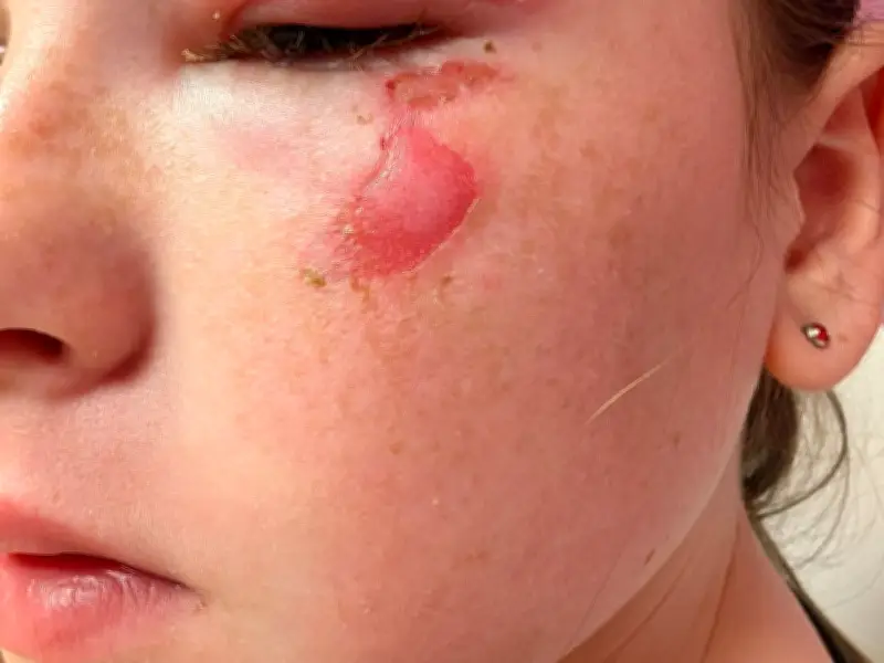 Five Terrifying Online Trends: Scottish Kids Burned by Squishy Toys