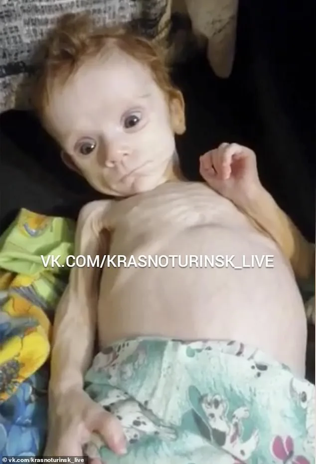 Emaciated Baby Found in Wardrobe in Russia, Mother Detained