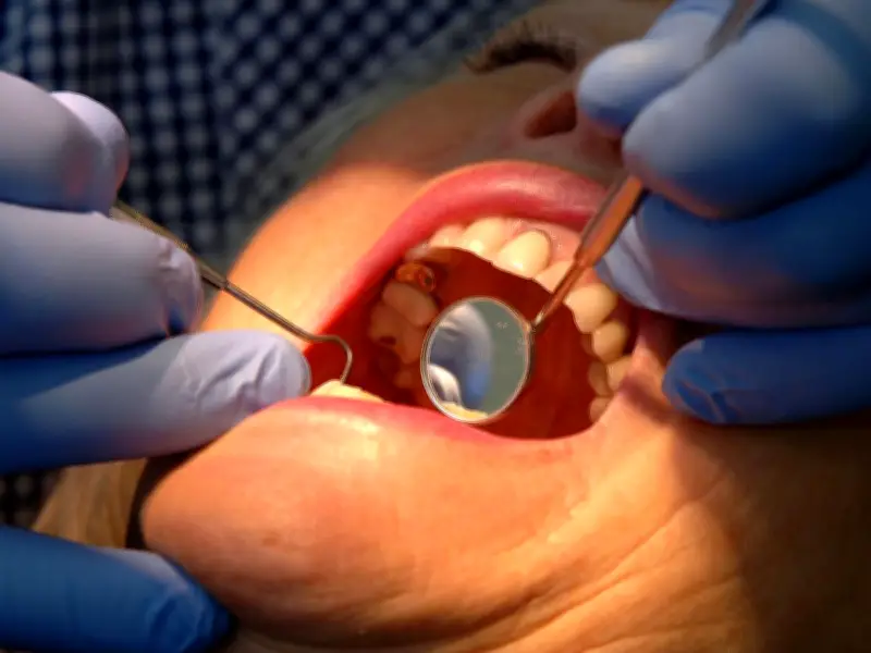Gateshead food bank users 'in agony' over poor dental health, doctor says
