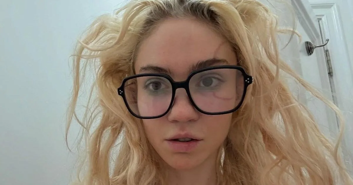 Grimes Baffles Fans With Circular Face Tattoo