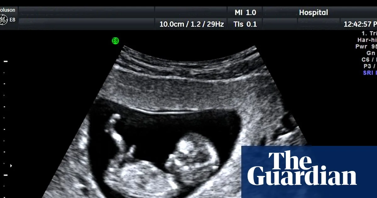 Unregulated Pregnancy Scan Clinics Endanger Lives, Experts Warn