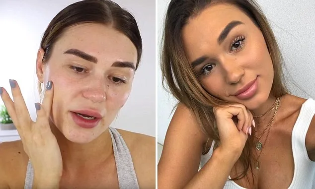 Five-Minute Acne Cover-Up: Makeup Expert's Simple Hack Without Foundation