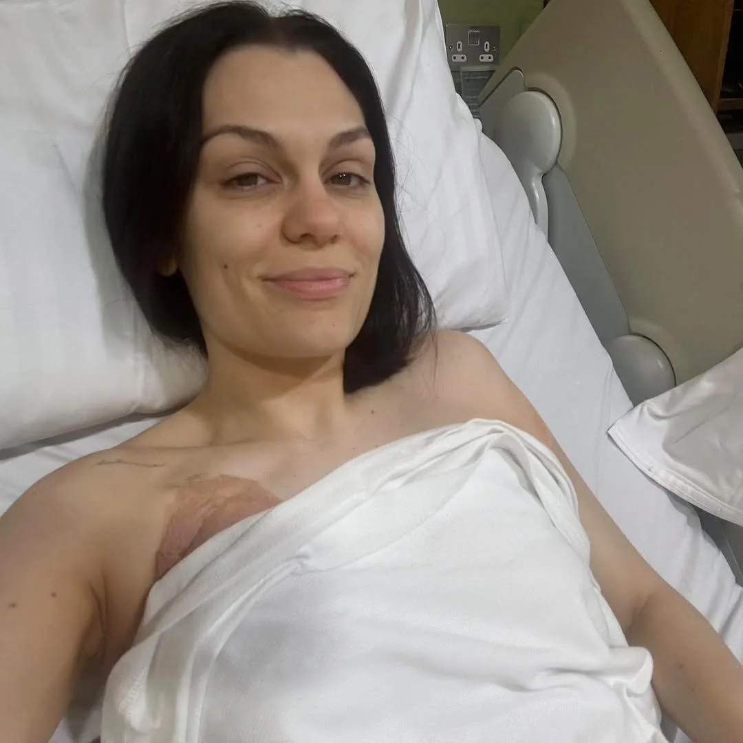Jessie J gives emotional update after breast cancer surgery