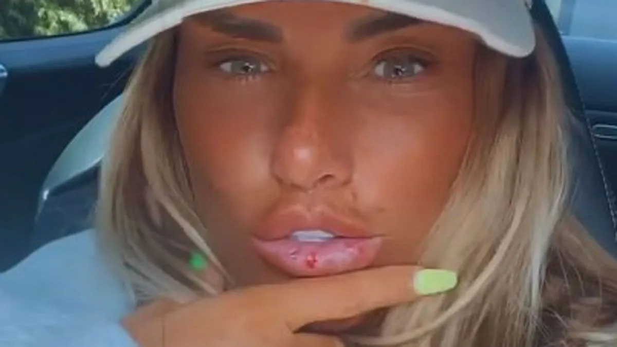 Katie Price's Kids Mock Her 'Elastic Band Lips' After Filler Dissolve