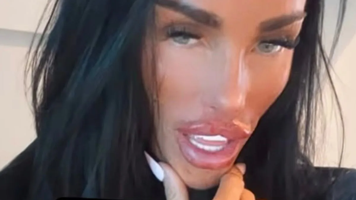 Katie Price Shows Off New Lips After Split Rumours